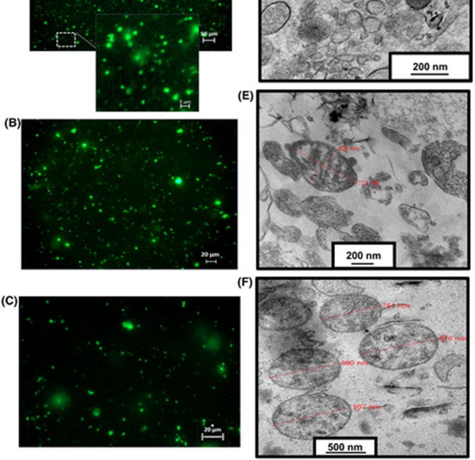 Freischwimmende Mitochondrien und freischwimmende DNA