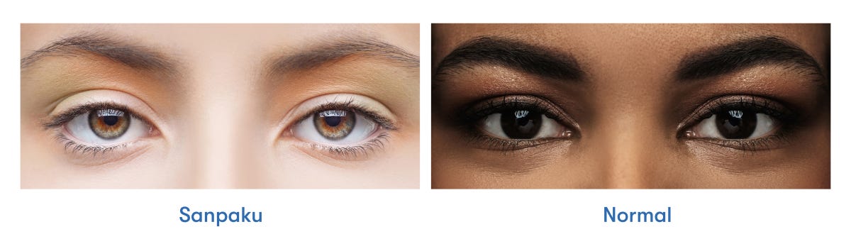 What Are Sanpaku Eyes? | 1-800 Contacts