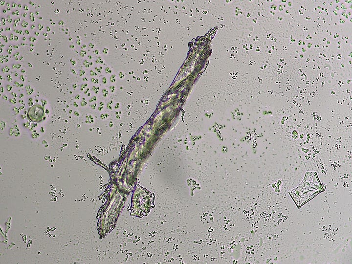'Things' in urine sample.