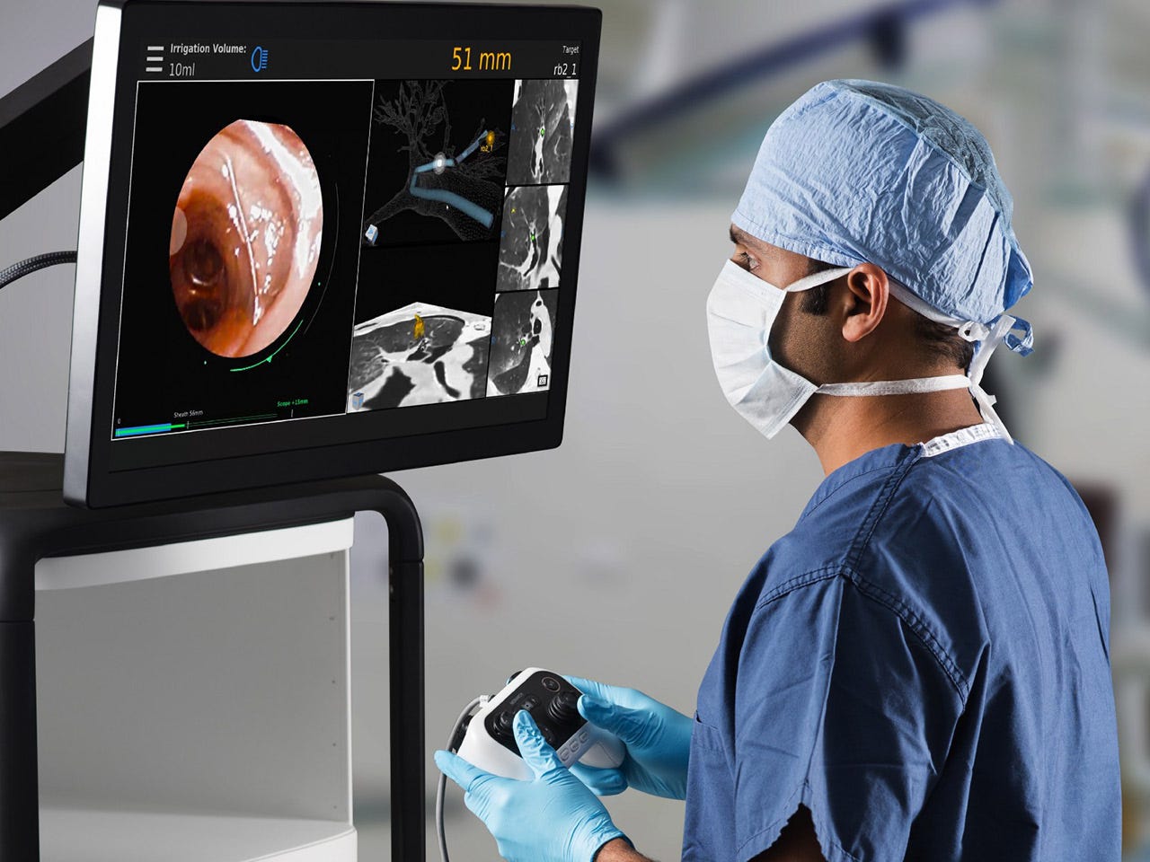 Franciscan Health Indianapolis Uses Monarch Robotic Surgery To Advance Lung  Cancer Care | Franciscan Health