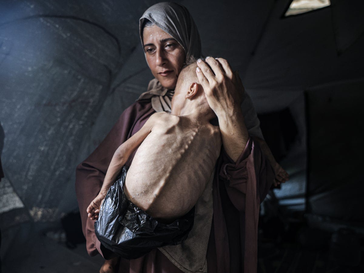 Starvation in Gaza is destroying communities – and will leave generational scars | Gaza | The Guardian Starvation in Gaza is destroying communities – and will leave generational scars | Gaza | The Guardian