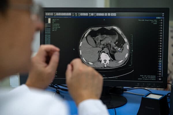 In China, A.I. Finds Pancreatic Cancer That Doctors May Miss - The New York Times In China, A.I. Finds Pancreatic Cancer That Doctors May Miss - The New York Times