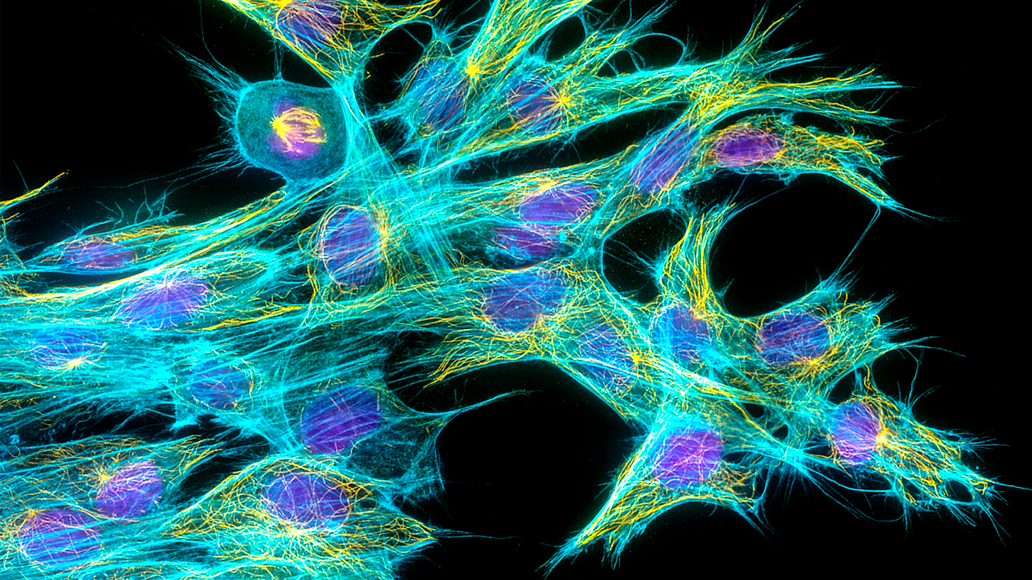 Light microscopy image of fibroblast cells. The cell nuclei are stained purple; parts that make up the rod-like structures of the cytoskeleton are stained cyan for actin filaments and yellow for the microtubule filaments.