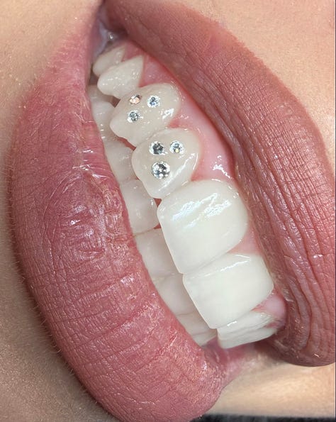 tooth gems italy milan kola payer