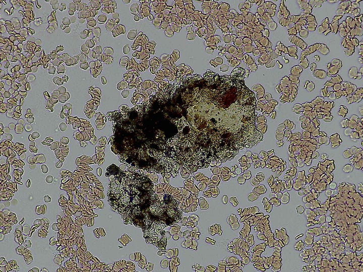 Blood sample 'things.