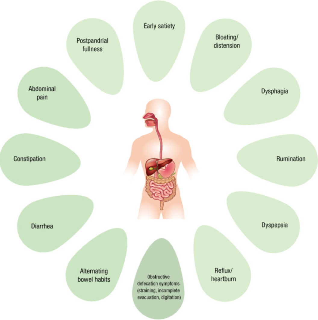 An illustration of a human body is centered on the page, surrounded by green circular dots, each labeled with a gastrointestinal symptom: constipation, diarrhea, reflux, abdominal pain, and bloating. The image visually emphasizes that these symptoms are commonly experienced throughout the digestive system. A caption below or alongside the body reads: “Various gastrointestinal symptoms have been reported to occur significantly more often in patients with HSD/hEDS compared with non‐HSD/hEDS controls.” The overall design highlights the widespread nature of GI issues in individuals with hypermobility disorders. An illustration of a human body is centered on the page, surrounded by green circular dots, each labeled with a gastrointestinal symptom: constipation, diarrhea, reflux, abdominal pain, and bloating. The image visually emphasizes that these symptoms are commonly experienced throughout the digestive system. A caption below or alongside the body reads: “Various gastrointestinal symptoms have been reported to occur significantly more often in patients with HSD/hEDS compared with non‐HSD/hEDS controls.” The overall design highlights the widespread nature of GI issues in individuals with hypermobility disorders.