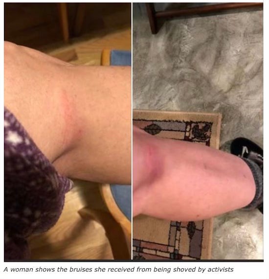 Woman received a bruise from a trans activist at the Seattle Library