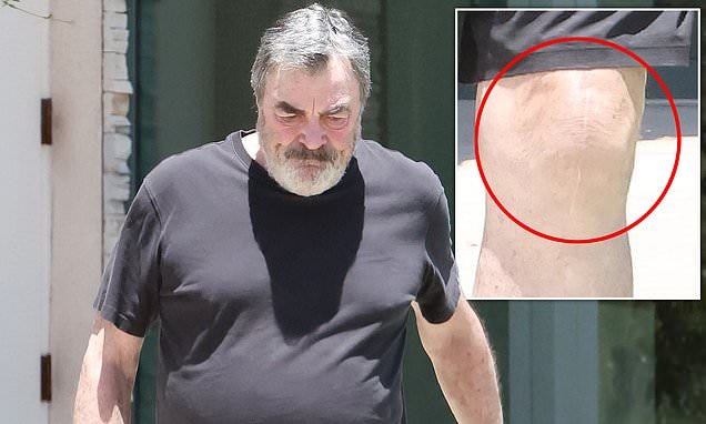 Tom Selleck fans spot detail that may explain why unrecognizable Blue  Bloods star looked rough in first public appearance since show was brutally  axed | Daily Mail Online
