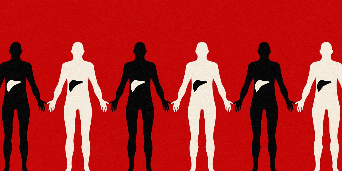 A liver transplant, from start to finish