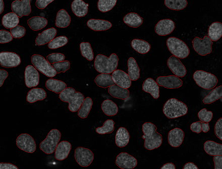 gnf-segmented-41 gnf-segmented-41