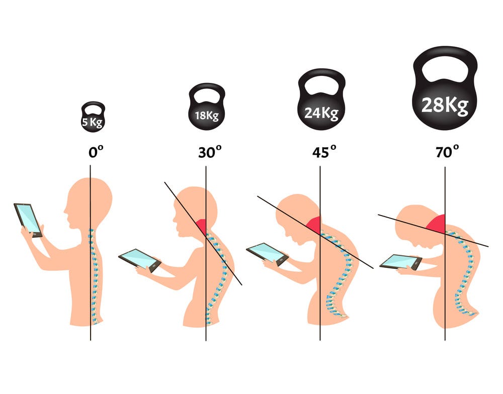 Improve Your Posture for Better Spine Health | Elevate Chiropractic -  Elevate Chiropractic