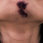 Cuerpo de texto #3: Confesión Sublime