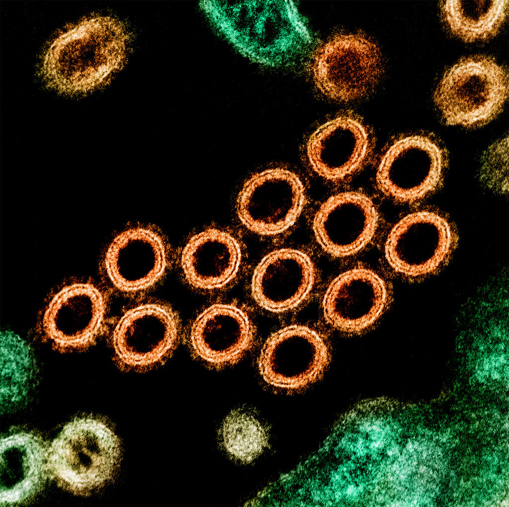Swine Flu Virus Particles | Colorized transmission electron … | Flickr