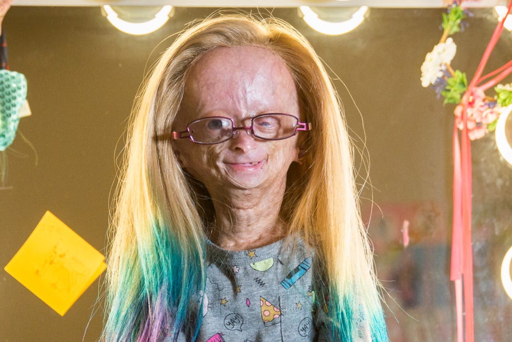 A YouTube star whose disability kinks and unkinks time is facing a camera in a multi-colored wig she once showed her fans how she washes.