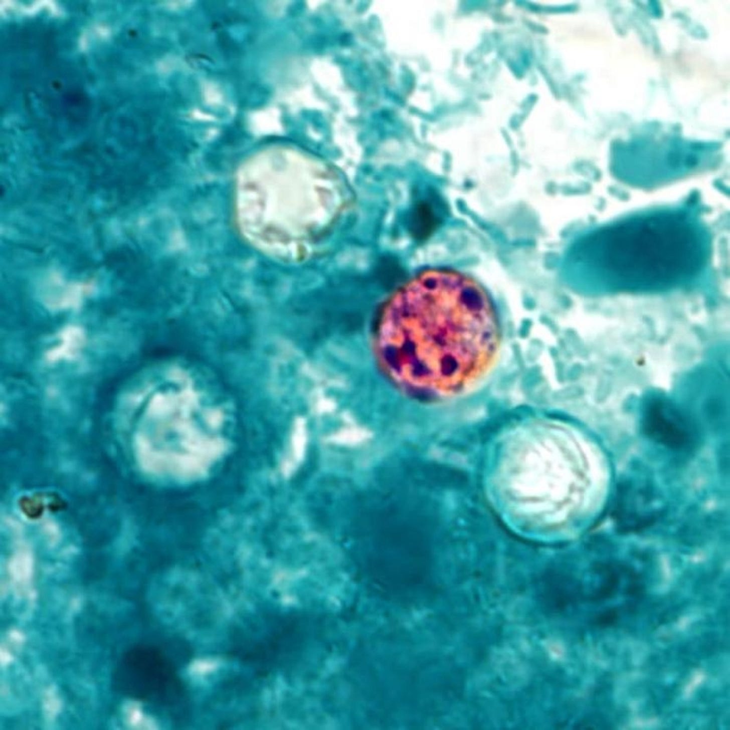 What is cyclospora? Here's how the parasite spreads | National Geographic