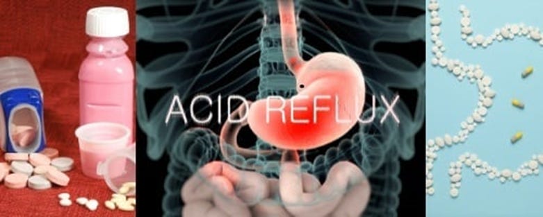 Acid Reflux Heartburn Treatments