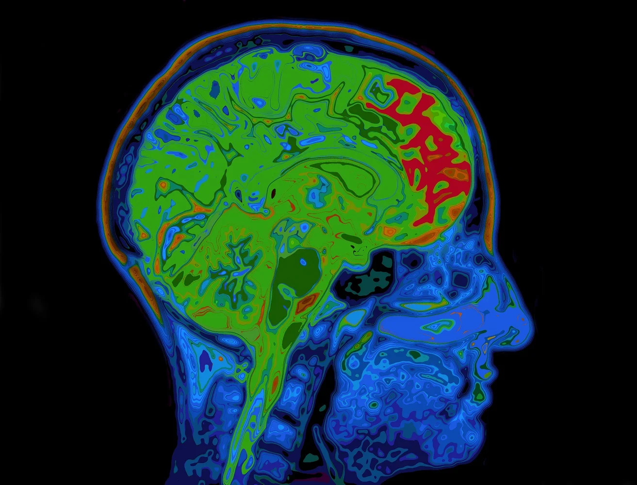 Brain scans – CT scan, MRI scan | The Brain Tumour Charity