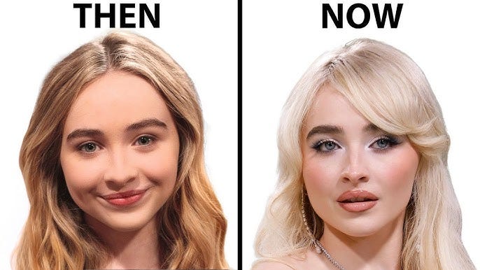Sabrina Carpenter's NEW FACE | Plastic Surgery Analysis Sabrina Carpenter's NEW FACE | Plastic Surgery Analysis