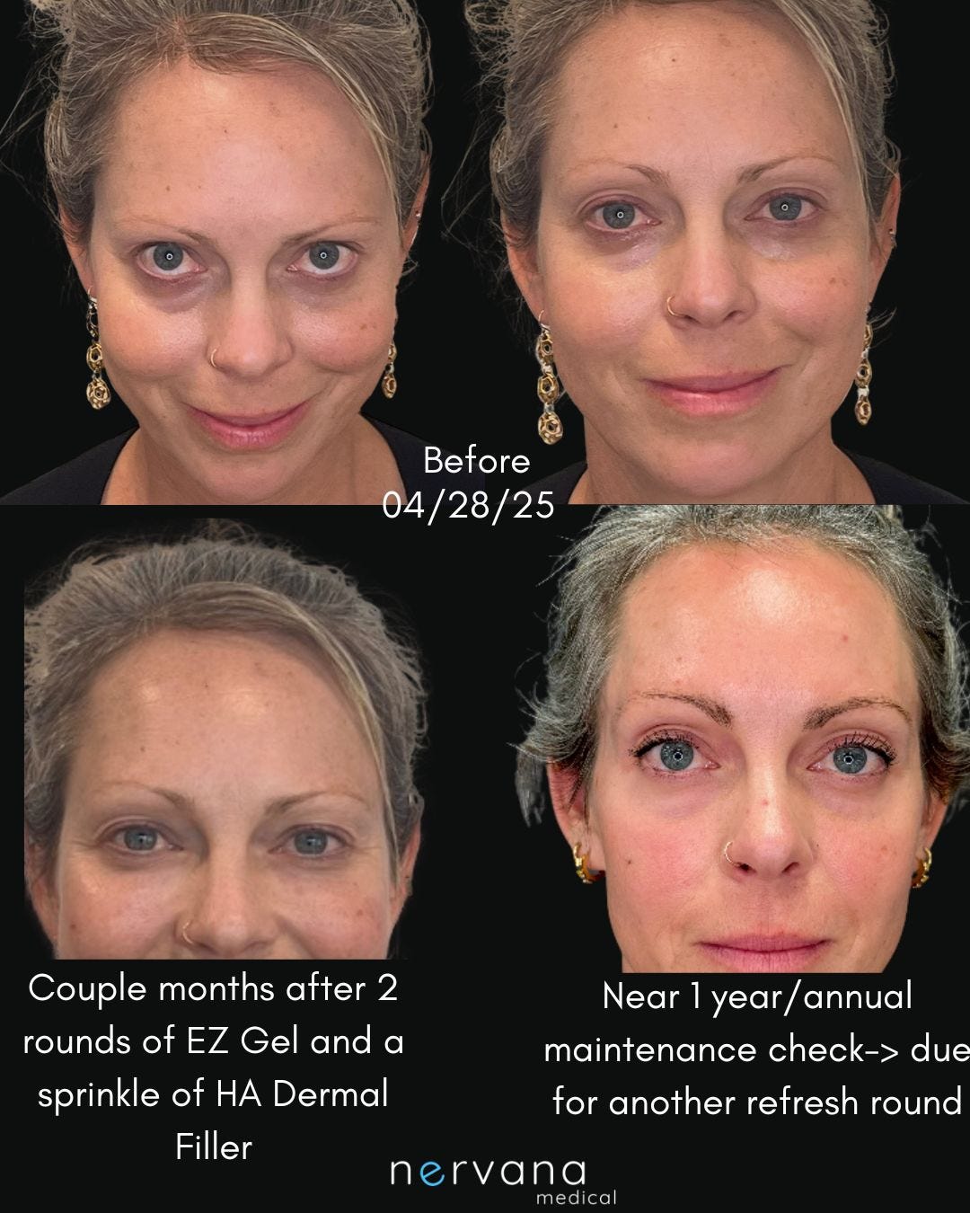 PRF/EZ Gel in Sandy, UT