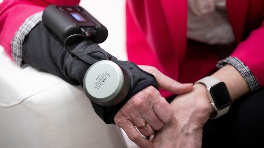 Luva apresentada em feira de tecnologia pode conter tremores causados pelo  mal de Parkinson; entenda