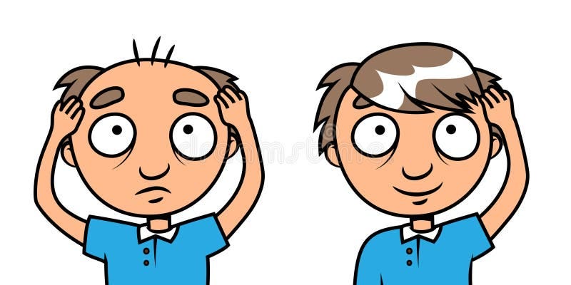 Bald Hair Man Stock Illustrations – 3,617 Bald Hair Man Stock  Illustrations, Vectors & Clipart - Dreamstime Bald Hair Man Stock Illustrations – 3,617 Bald Hair Man Stock  Illustrations, Vectors & Clipart - Dreamstime