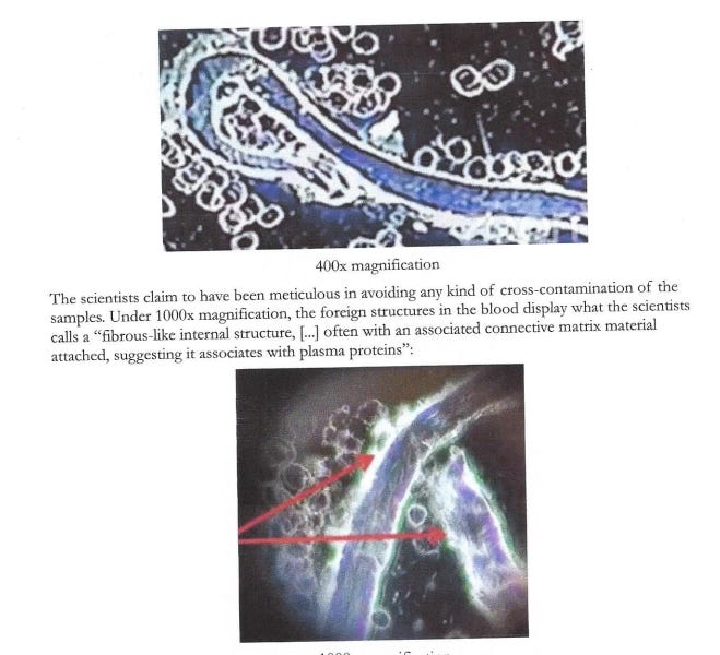 There's a Reason They're In There