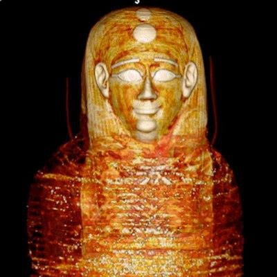2023 01 24 01 58 5834 2023 01 24 Golden Mummy 3 D Ct Criss Cross Wrappings 20230124012427