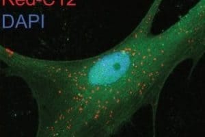 Microscopy image of astrocyte containing lipid droplets.