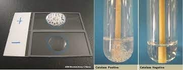 catalase test: introduction, principle, procedure,... Catalase Test- Principle, Procedure, and Result Interpretation.
