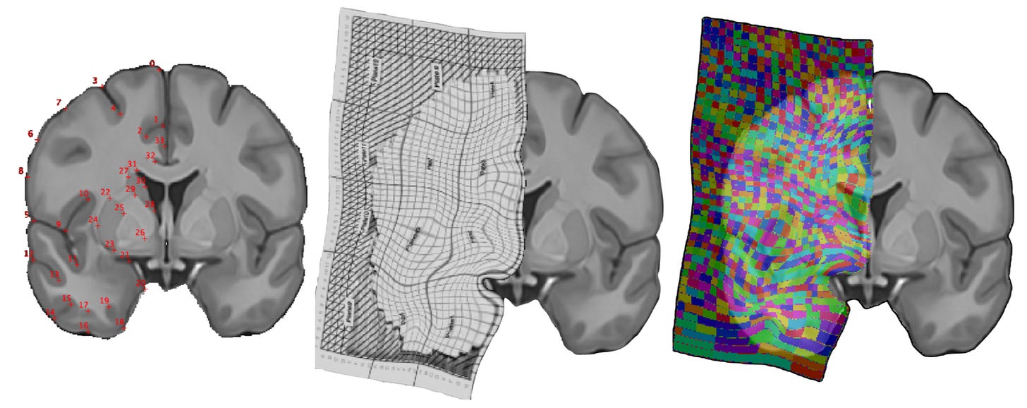 Process for creating a map of the brain energetic landscape. Process for creating a map of the brain energetic landscape.