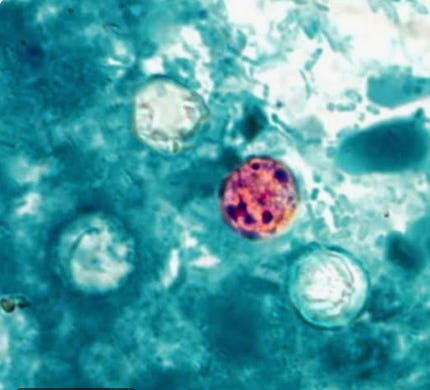 Manatee County Reports First Confirmed Cyclosporiasis Case of 2026