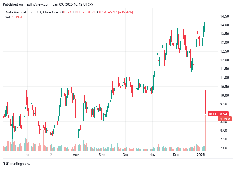 TradingView chart