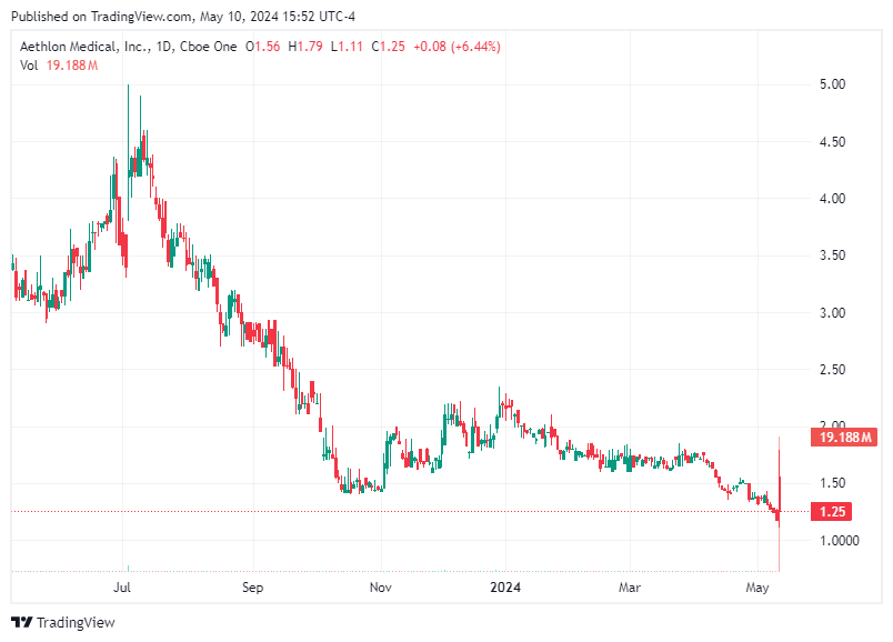 TradingView chart TradingView chart