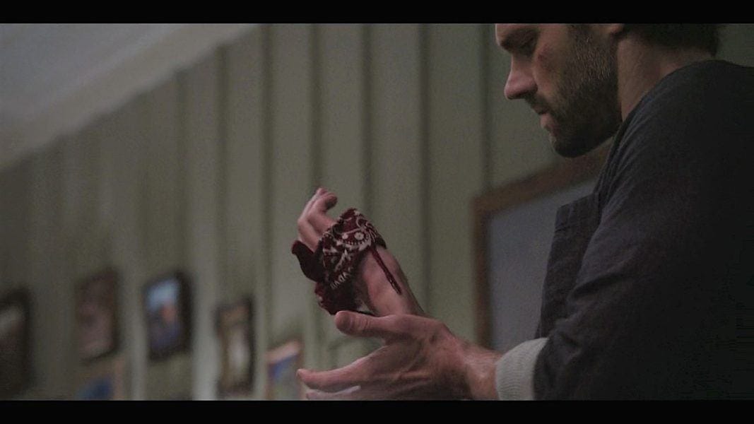 Jared Padalecki watching his hand bleed hard on Walker set. Jared Padalecki watching his hand bleed hard on Walker set.