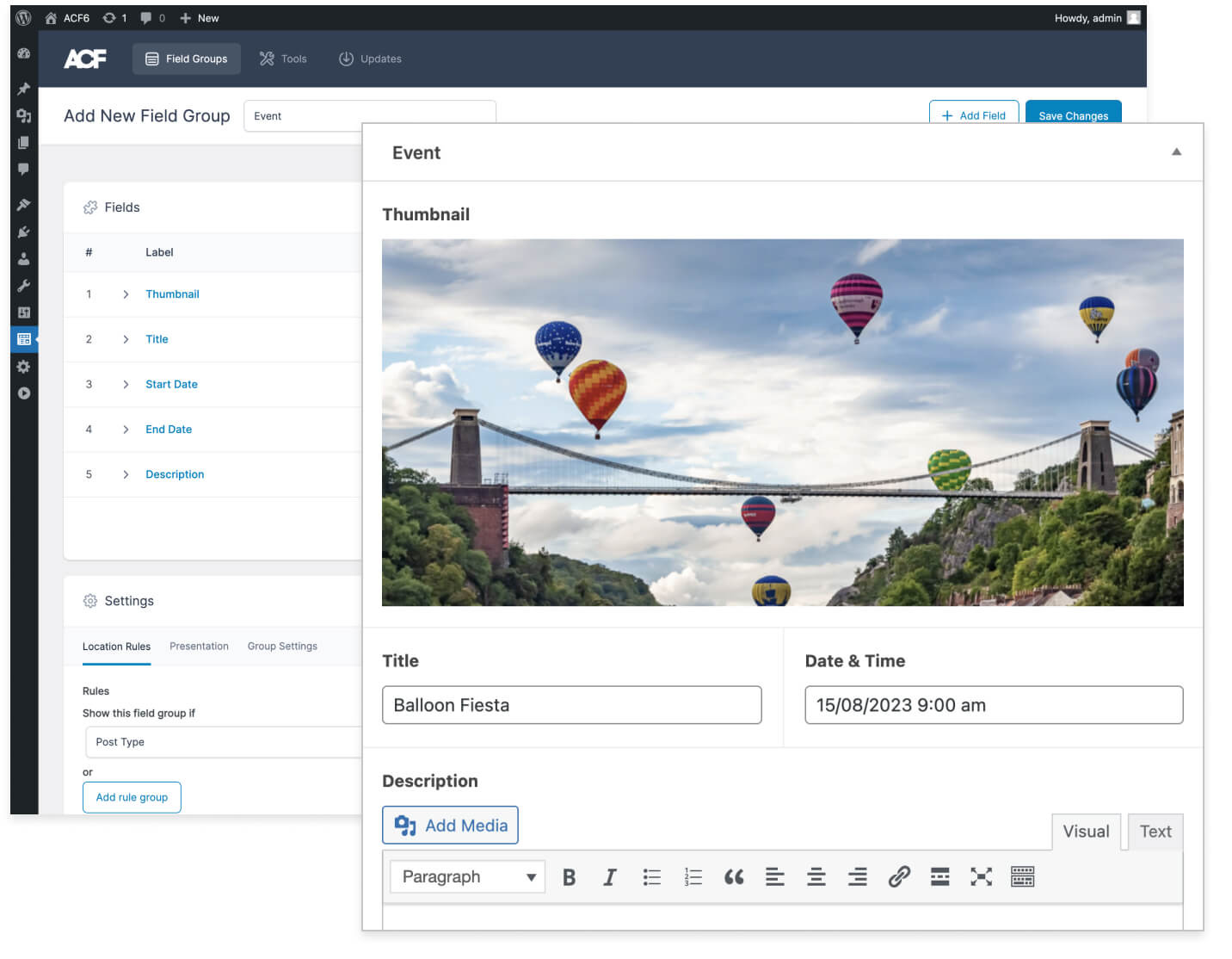 ACF | Advanced Custom Fields Plugin for WordPress