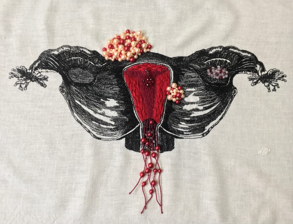 An embroidery of a uterus stitched in black thread on white linen with texture like a woodcut. The mesometrium spreads like wings, the ovaries are ovals on the mesometrium, and the fimbriae on the ends of the fallopian tubes look like sea anemones. Inside the uterus, the edges of the endometrium are stitched in bright red thread with long and short stitch in a textured leaf pattern. The centre endometrium is filled with the same texture but in burgundy with thinner thread. The edges between the burgundy and the bright red are filled with single strand satin stitch with curlicue edges. There is an apple-sized half circle fibroid on the left upper area of the uterus and a strawberry sized one on the right lower side. Both fibroids are made of red, pink, and cream beads of various sizes. Another strawberry sized section of clear, purple, and red beads is a cyst over the right ovary, and a small section of dark red and purple beads are a polyp inside the endometrium. There are long burgundy strings hanging from the bottom of the endometrium with medium and large red beads on them that extended past the vaginal opening. The initials L. P. are stitched in white on the right side of the image. An embroidery of a uterus stitched in black thread on white linen with texture like a woodcut. The mesometrium spreads like wings, the ovaries are ovals on the mesometrium, and the fimbriae on the ends of the fallopian tubes look like sea anemones. Inside the uterus, the edges of the endometrium are stitched in bright red thread with long and short stitch in a textured leaf pattern. The centre endometrium is filled with the same texture but in burgundy with thinner thread. The edges between the burgundy and the bright red are filled with single strand satin stitch with curlicue edges. There is an apple-sized half circle fibroid on the left upper area of the uterus and a strawberry sized one on the right lower side. Both fibroids are made of red, pink, and cream beads of various sizes. Another strawberry sized section of clear, purple, and red beads is a cyst over the right ovary, and a small section of dark red and purple beads are a polyp inside the endometrium. There are long burgundy strings hanging from the bottom of the endometrium with medium and large red beads on them that extended past the vaginal opening. The initials L. P. are stitched in white on the right side of the image.
