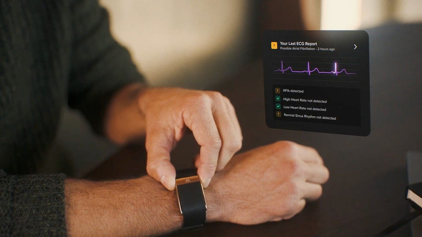 The Whoop MG on someone's wrist showing the ECG feature with a screenshot of how the app works