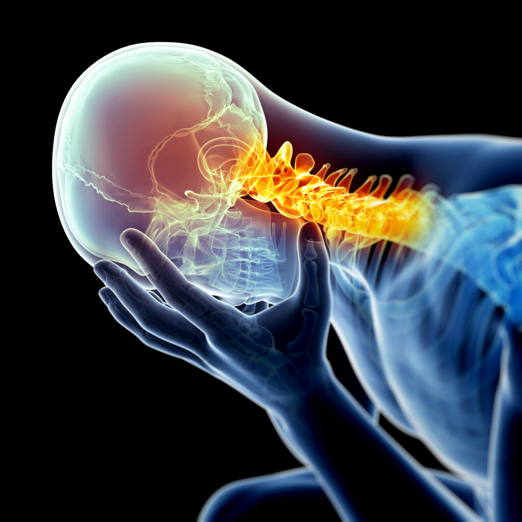 Epidural Blood Patch for Spinal Headaches - Restorative Pain Management