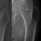 Evolution of an Indication