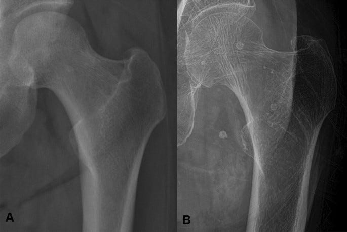 figure 3 figure 3