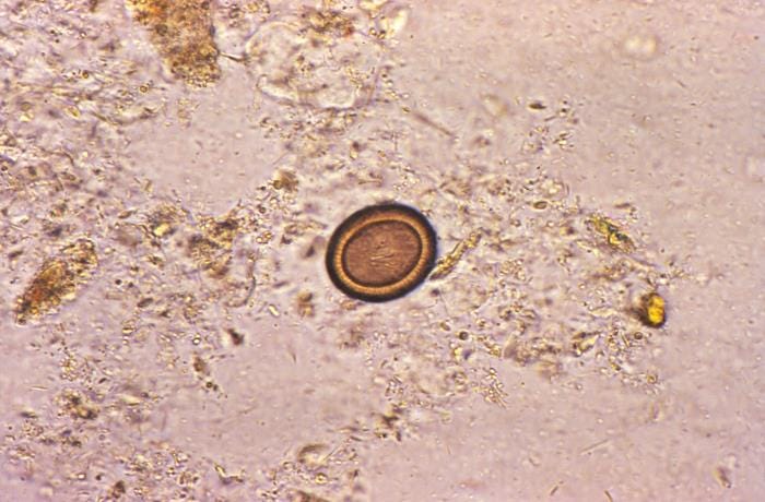 Goodova Taenia Saginata Ova Frontiers | Case Report: Molecular Diagnosis