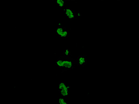 photos on the right and left are microclots.  they were fluorescent green blobs scattered against a dark background.  the middle picture is hyperactivated platelets - they are much smaller, bright red and yellow dots scattered against a black background