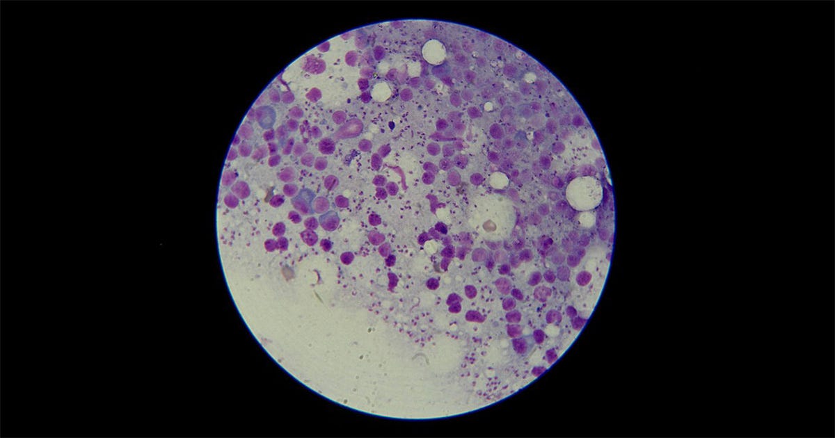 A imagem mostra uma visão microscópica circular com fundo preto, contendo diversas estruturas celulares coradas em tons de roxo e rosa sobre um fundo claro A imagem mostra uma visão microscópica circular com fundo preto, contendo diversas estruturas celulares coradas em tons de roxo e rosa sobre um fundo claro