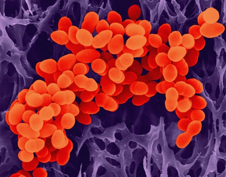 A False coloured scanning electron micrograph of a cluster of spherically-shaped bacterium coloured in red
