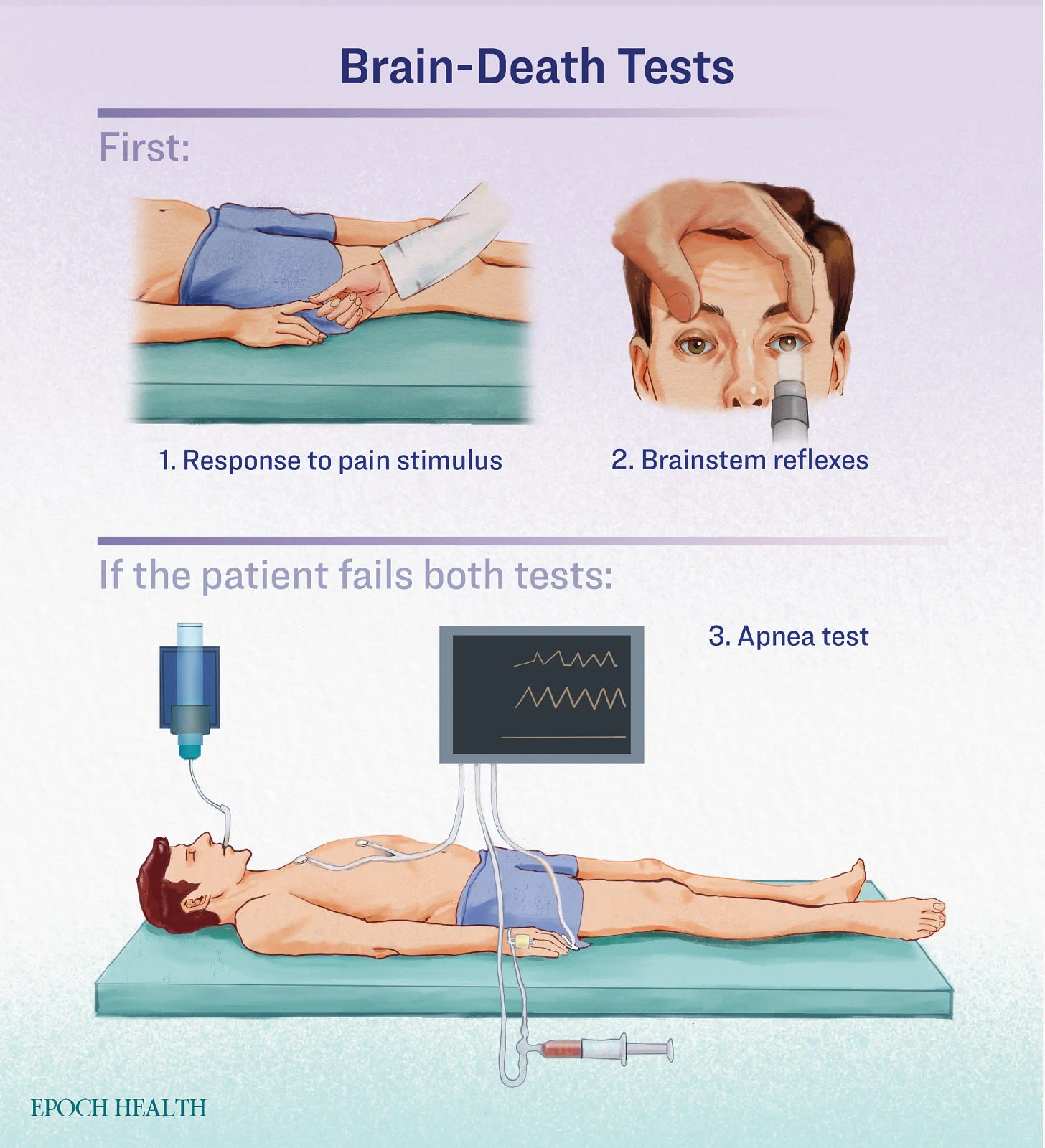 Brain Dead People May Not Be Dead–Here’s Why