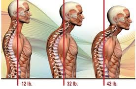 Neck pain Neck pain