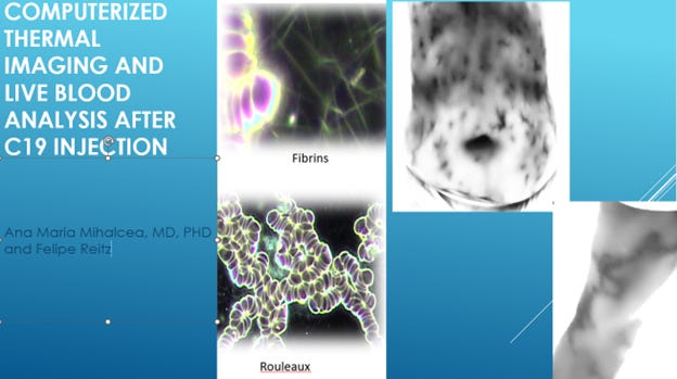 Computerized Thermographic Imaging and Live Blood Analysis Post C19 Injection 