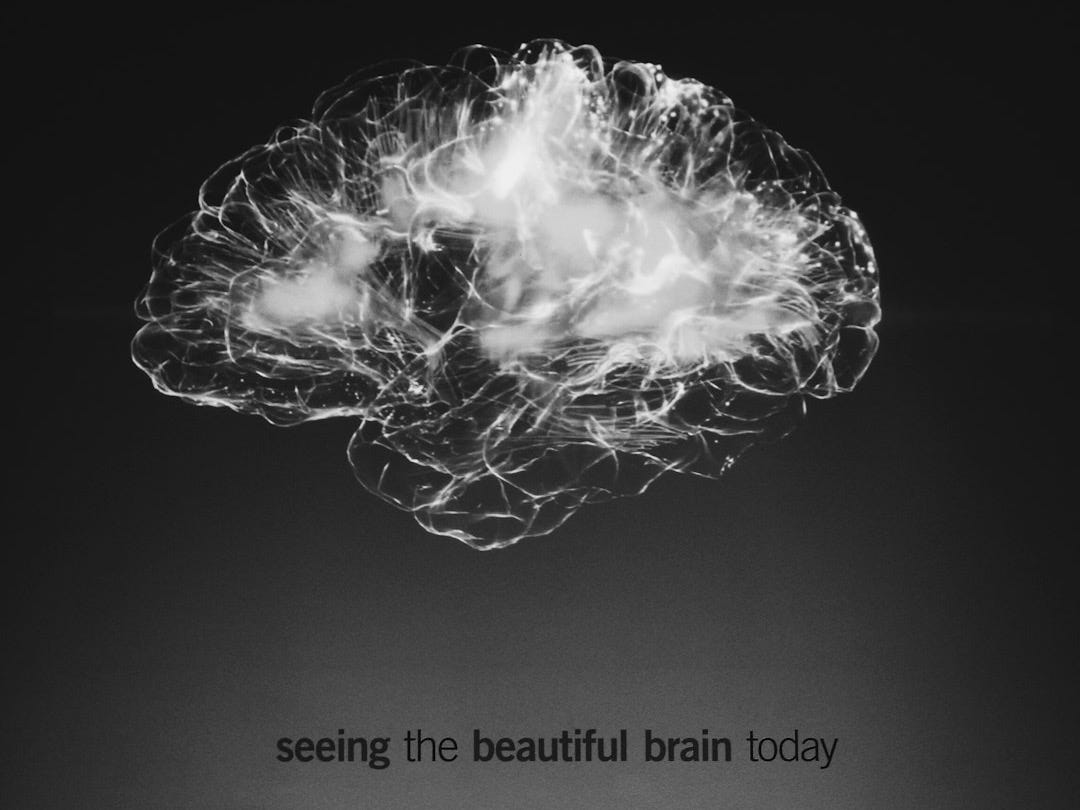 a black and white photo of a brain a black and white photo of a brain