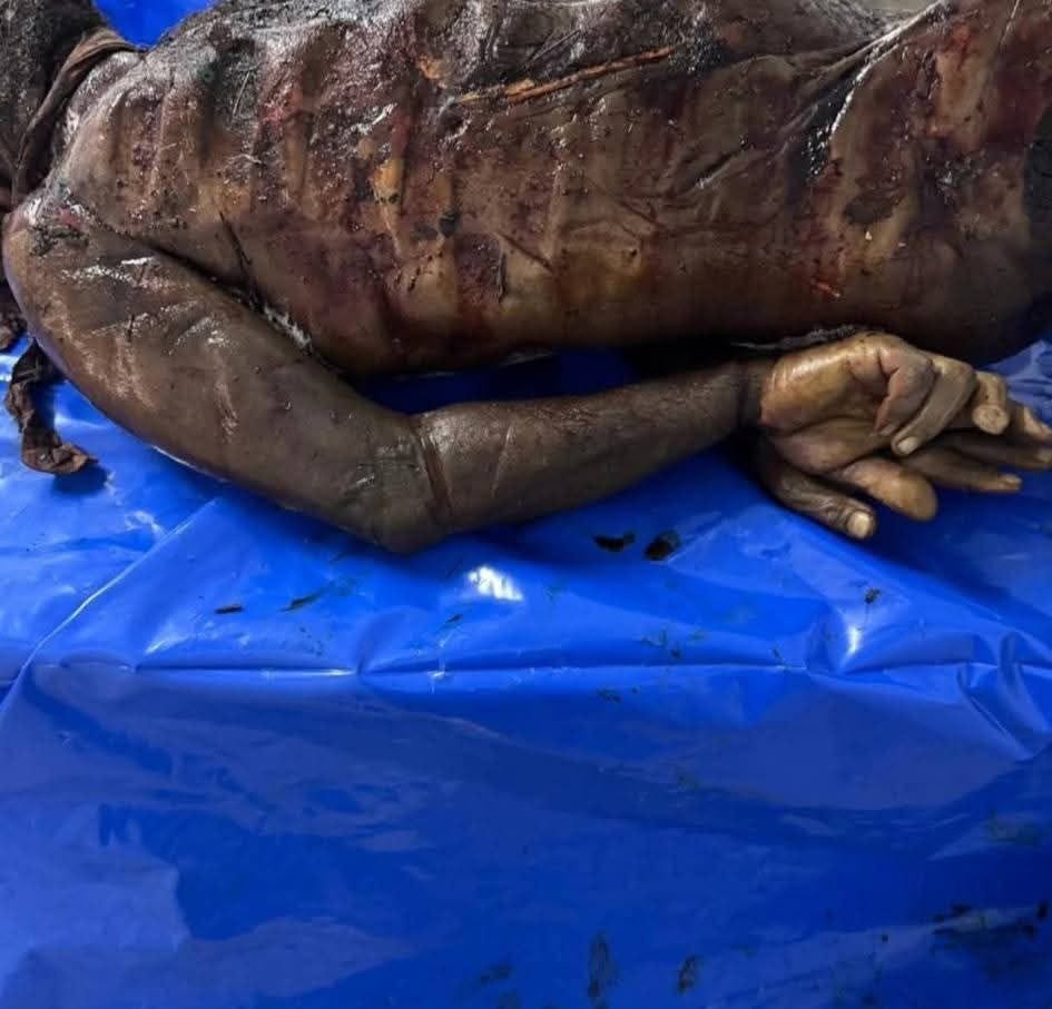This is what Israel is doing to the bodies of dead Palestinian hostages - Palestine Will Be Free