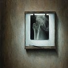 What to Ask Before Your Next Bone Density Scan